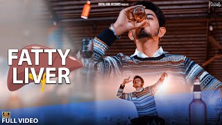 Love Bhangu  Fatty Liver Official Video Latest Punjabi Song 2021 [upl. by Aspasia]