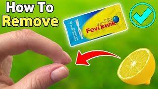 how to remove feviquick from hand  feviquick remover from hand  how to remove feviquick [upl. by Ayokal]