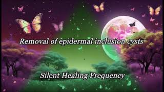 Removal of epidermal inclusion cysts Silent Healing Frequency [upl. by Christianson]