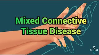 Mixed Connective Tissue Disease  CRASH Medical Review Series [upl. by Edac]