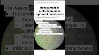 Management of preterm prelabor rupture of membranes [upl. by Libbna]