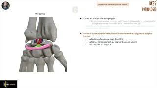 Imagerie des pathologies du DCSS [upl. by Jaco]