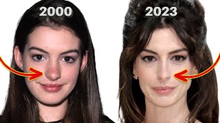 Anne Hathaway’s Before and After Denies Nose Job Lorry Hill [upl. by Bunting]