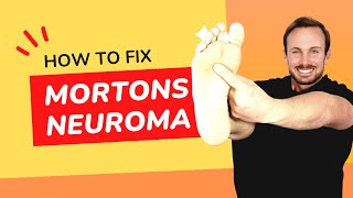 Shooting Sharp Foot Pain  Mortons Neuroma  Treatment No Surgery [upl. by Turk]