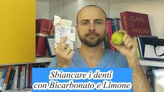 video sbiancamento [upl. by Siladnerb]