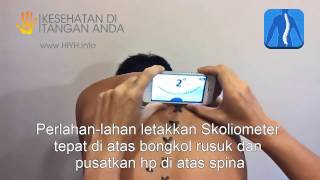 Scoliometer untuk iPhone dan Android  CARA PAKAI [upl. by Flossi]