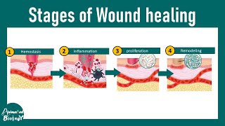 Wound healing stages  steps of wound healing  Wound healing and injury [upl. by Malinde]