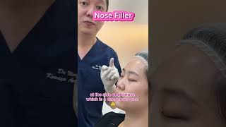 Where and How Fillers are Injected [upl. by Novek682]