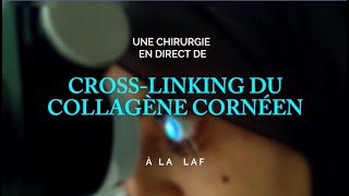 Procédure en direct de CROSSLINKING DU COLLAGÈNE CORNÉEN à la LAF Réalisée par Pr FARHAD HAFEZI [upl. by Roux]