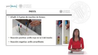 IMVIC Indol Rojo de metilo VogesProskauer Citrato   UPV [upl. by Skye611]