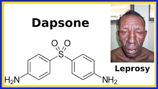 dapsone [upl. by Philpot]