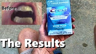 CREST Whitening Strips 3D BeforeAfter 12 Treatments Vivid Plus Teeth Enamel Cleaning 30 minutes [upl. by Manvell]