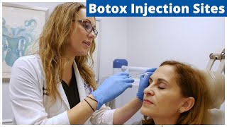 Botox Frontalis Glabella amp Nefertiti Treatment  Botox Injection Sites [upl. by Enyahs]