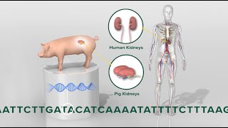 Pigtohuman kidney transplant 3D animation [upl. by Warden912]