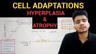 Hyperplasia amp Atrophy  Cell Adaptations 23  General Pathology  EOMS [upl. by Gnehs]