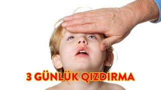 Üç günlük qızdırma  Rozeola 6cı xəstəlik [upl. by Nylaras]