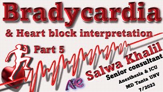 ECG 5 Bradycardia amp Heart block interpretations [upl. by Savvas]