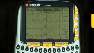 ReadyLink 12LEAD ECG Training Video [upl. by Larok]