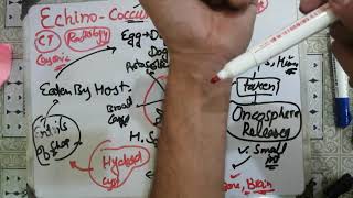 echinococcusgranulosus🌹🌹 echinococcus 2 life cycle parasitology microbiology levinson [upl. by Inalak]