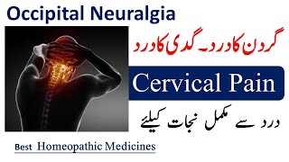 Occipital Neuralgia  گردن کا درد ، گدی کا درد  Best Homeopathic Medicines for Cervical Pain [upl. by Nnylirret]