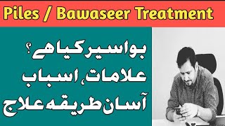 Bawaseer Ka Ilaj In Urdu Hindi  Piles Hemorrhoids Causes Symptoms amp Treatment Bawasir Ka Desi Ilaj [upl. by Amej]