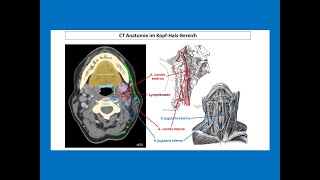 CT Anatomie im KopfHalsBereich  Strahlentherapie Prof Hilke Vorwerk [upl. by Ssepmet]