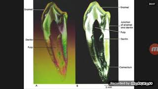 Ground section of teeth [upl. by Ahseekal427]