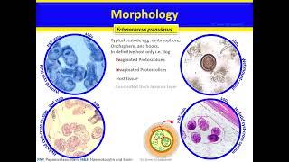 Echinococcus granulosus and Echinococcus multilocularis Cestodes [upl. by Onfroi330]