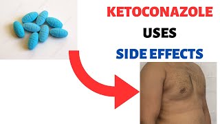 KETOCONAZOLE NIZORAL Uses Side effects Review Shampoo Cream Soap Lotion [upl. by Vinay472]