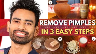 ULTIMATE Ayurvedic Routine to Get Rid of Pimples amp Acne Permanently Men amp Women [upl. by Bigot]