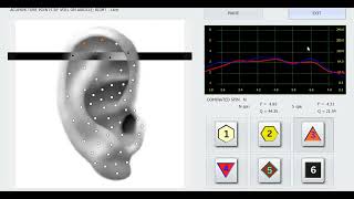 biophilia tracker rife clark reprinter [upl. by Alleroif163]