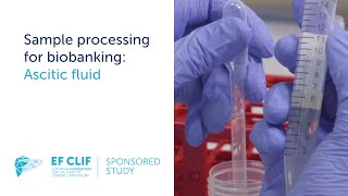 Sample processing for biobanking Ascitic fluid [upl. by Yrellih]