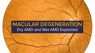 Macular Degeneration Explained  Diagnosis Symptoms and Treatment of Dry and Wet AMD [upl. by Plunkett404]