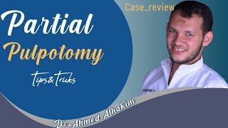 Partial pulpotomy case review  Dr Ahmed Alhakim [upl. by Mirisola]