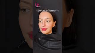 Lips amp Nasolabial fold recommended рек top beauty aesthetic lifting lips skincare fullface [upl. by Dachy]