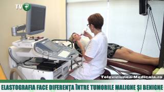 Elastografia face diferenta intre tumorile maligne si benigne [upl. by Nievelt]