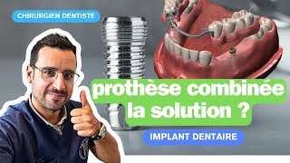 Dents mobiles  les implants dentaire pour stabiliser un appareil [upl. by Giannini]