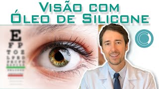 Na vitrectomia é obrigatório colocar gás ou óleo de silicone [upl. by Attelahs365]