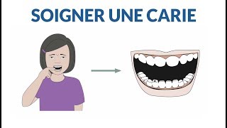 Comment soigner une dent cariée [upl. by Mimajneb]