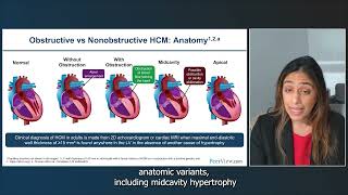 Making Strides in Hypertrophic Cardiomyopathy Guidelines Science and Strategies [upl. by Eniron]