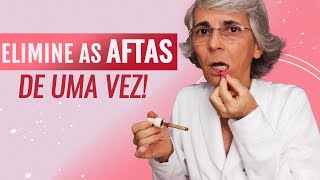 Causa das aftas [upl. by Surad]