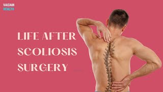 Life After Scoliosis Surgery [upl. by Kciredohr]