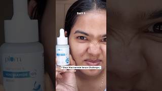 I applied niacinamide serum for 7 days trendingonshorts challenge [upl. by Nagram78]