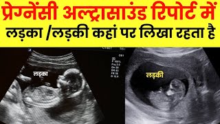 Pregnancy ultrasound se kaise pata krein ki ladka hai ya ladki [upl. by Hgielak]