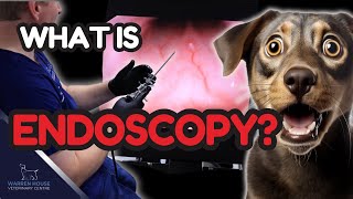 Inside Look Endoscopy Procedures Explained [upl. by Morice]