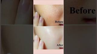 How to minimise open pores on face 💕skinbeautytips beatytips shortvideo shorts [upl. by Caritta705]