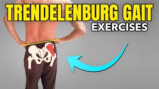 3 Exercises to Correct a Trendelenburg Gait Pattern [upl. by Delacourt150]