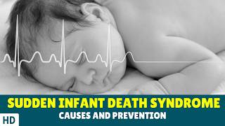 Sudden Infant Death Syndrome SIDS  Causes and Prevention [upl. by Eimma262]