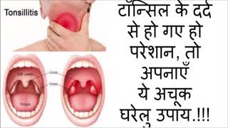 टॉन्सिल गले में घाव और गला बैठने पर करे ये आसन घरेलु उपचार  Tonsil home remedy in hindi [upl. by Elrahc637]