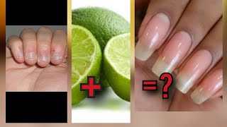 5 astuces naturelles pour faire pousser ses ongles [upl. by Dauf]